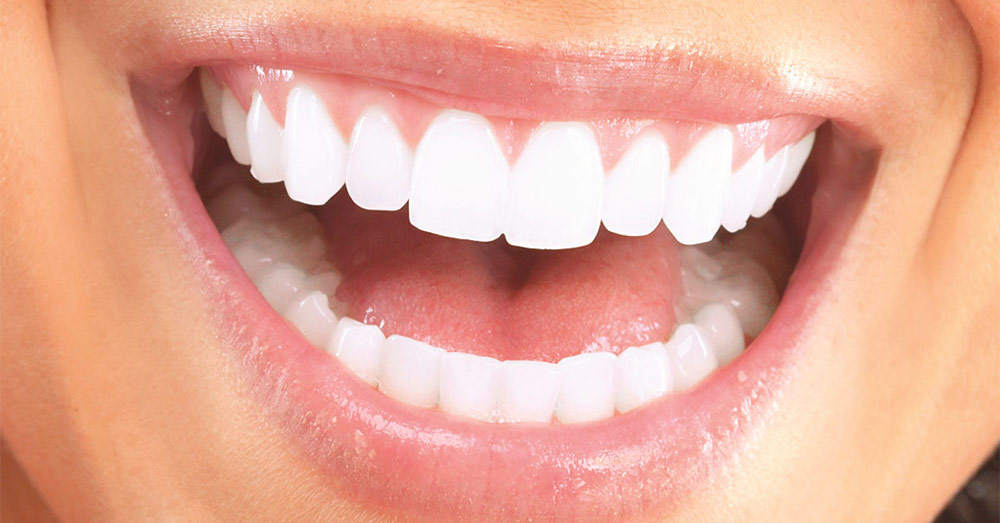 بررسی تفاوت های اصلی کامپوزیت دندان و روکش